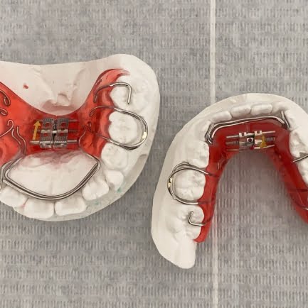 ortodoncia para dentistas