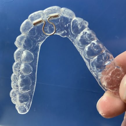 ortodoncia invisible alicante