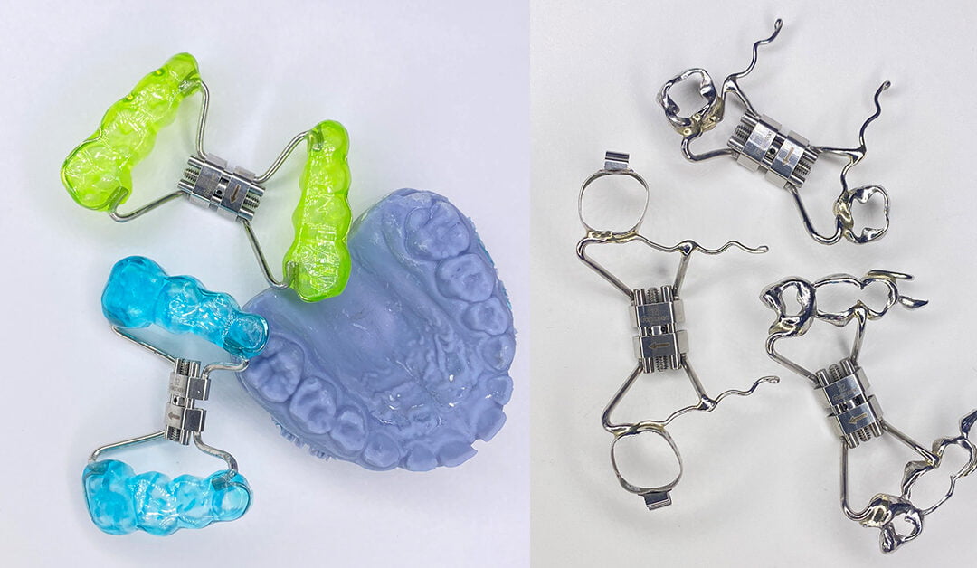 Descubre cómo los disyuntores ortodóncicos pueden transformar la salud bucal de tus pacientes