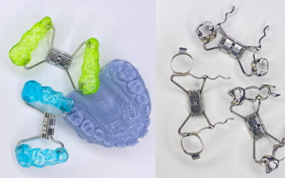 Ortodoncia fija: Corrige tu sonrisa de manera efectiva